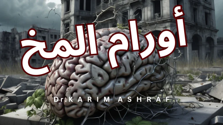 أورام المخ - الدكتور كريم أشرف