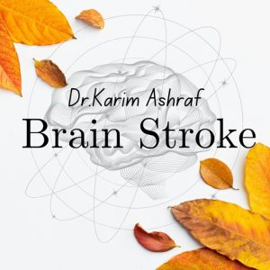 brain stroke